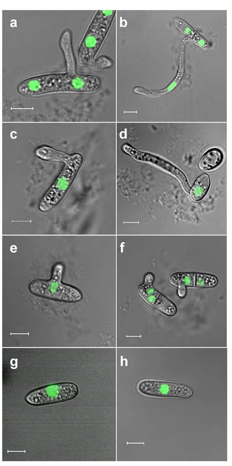 Cell cycle and cell death are not necessary for appressorium formation and plant infection in ...