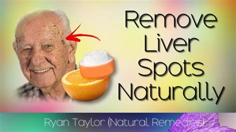 Remove Liver Spots Naturally (Age Spots Natural Remedies) - YouTube