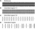 Frontiers | Behavioral changes in response to sound exposure and no spatial avoidance of noisy ...