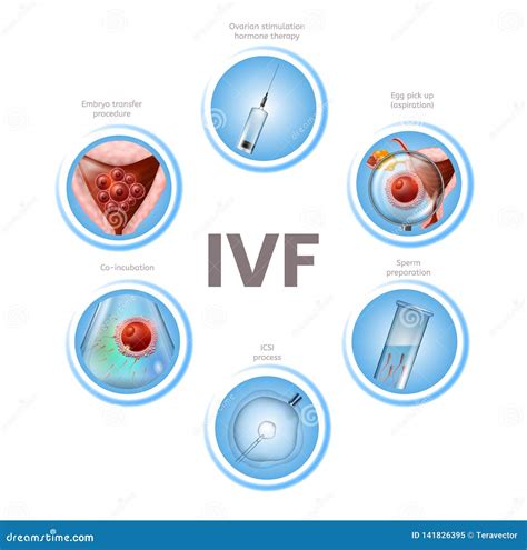 Stages Of In Vitro Fertilization Medical Banner Vector Illustration | CartoonDealer.com #145358656