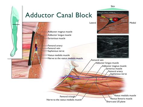 Lower extremity regional anesthesia: essentials of our current understanding | Regional ...