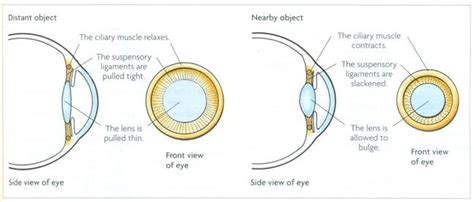 Science: The Real Cause Of Myopia - Endmyopia® - The Reduced Lens ...