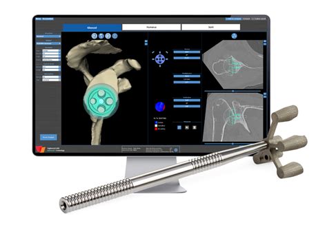 Stryker introduces Tornier shoulder arthroplasty portfolio in India