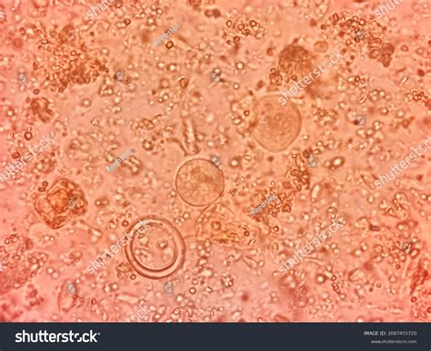 Entamoeba Coli: Over 44 Royalty-Free Licensable Stock Photos | Shutterstock