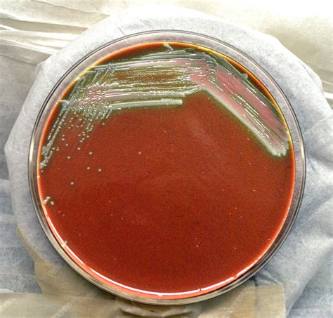 Free picture: gram, negative, francisella, tularensis, bacteria, grown, cysteine, heart, agar