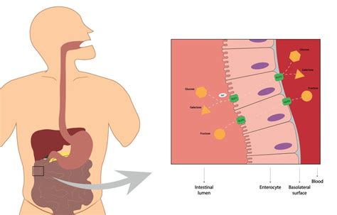 Malabsorption in Singapore - Alpha Digestive & Liver Centre