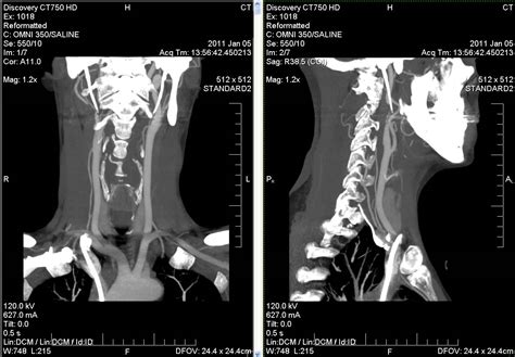 Just Keep Going: Neck MRI and CT scan images