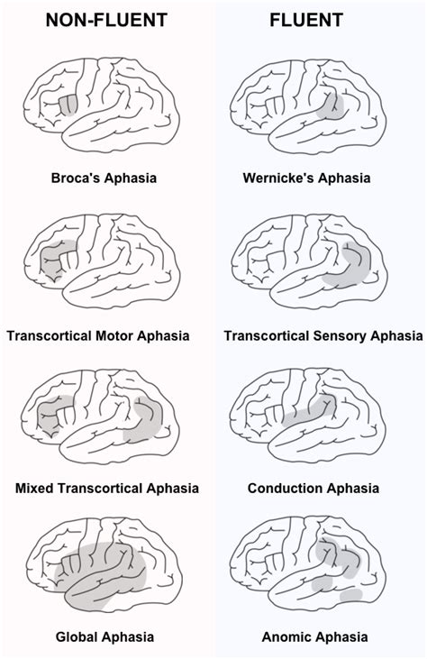 Different types of Aphasia