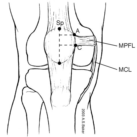 Patellofemoral Joint - Knee & Sports - Orthobullets