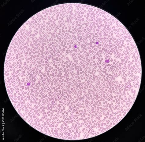 Foto de Normochromic and normocytic rbc blood smear. do Stock | Adobe Stock