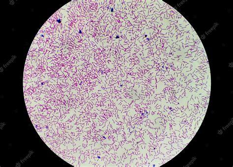 Gram Stain E Coli