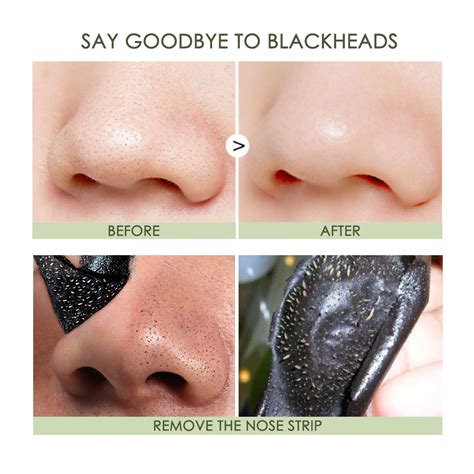 Blackheads Removal Strips