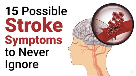 Prevent A Stroke: 15 Stroke Symptoms to Never Ignore