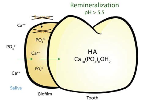 The Delicate Balance of Remineralization and Demineralization ...