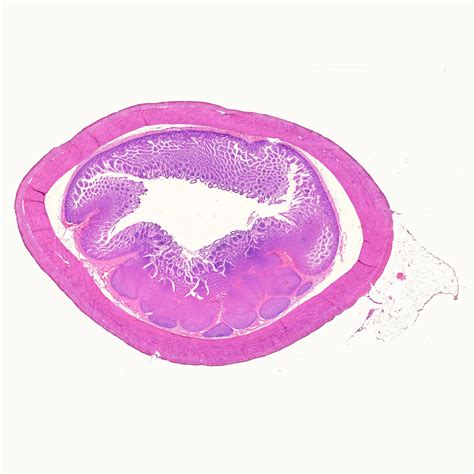 Human ileum cross-section histology slides, 7 µm sec., H&E Stain, human histology slides ...