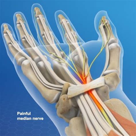 Carpal Tunnel Median Nerve Test