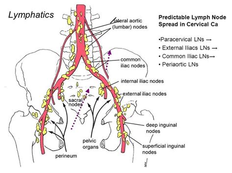 Image result for periaortic node | Map, Crohns, Chart