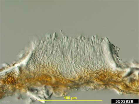 bitter rot and anthracnose (Colletotrichum gloeosporioides ) on common pear (Pyrus communis ...