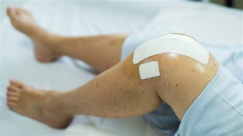 Goodbye knee replacements? A new hope for osteoarthritis treatment ...