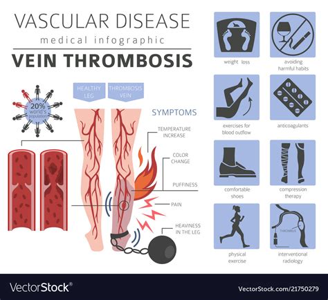 Vascular diseases vein thrombosis symptoms Vector Image