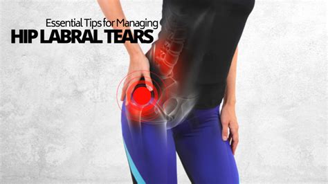 Hip Labral Tears Types