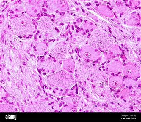 Dorsal root ganglion hi-res stock photography and images - Alamy