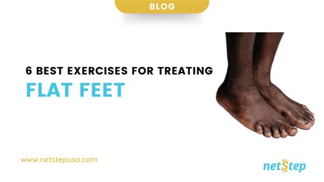 6 Best Exercises For Treating Flat Feet - netStep