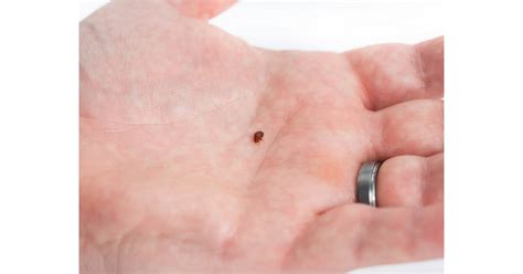 Bedbug Size