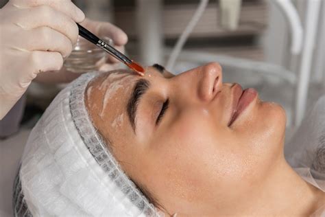 Your Quick Guide to Longer Lasting Chemical Peels for Hyperpigmentation ...