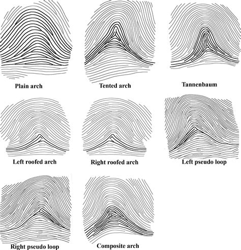 Different Types Of Fingerprints A Ulnar Loop B Radial - vrogue.co