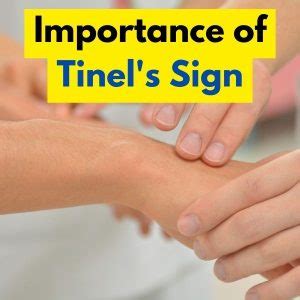 Mastering Tinel's Sign: The Ultimate Tool for Pinpointing Nerve Damage in 2023