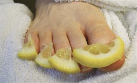 Use these 10 home remedies to deal with toenail fungus | Grandma's Things