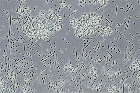 Lactic acid bacteria, light micrograph - Stock Image - C029/3446 - Science Photo Library