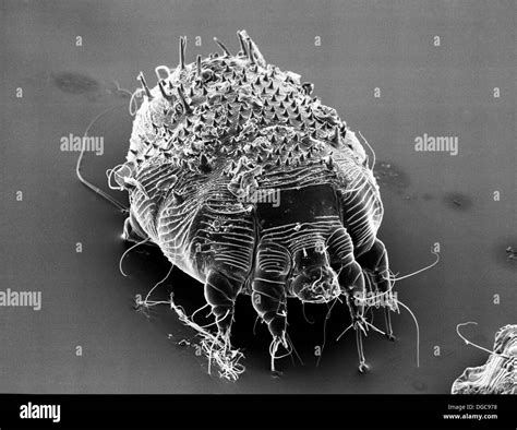 Scabies Eggs Under Microscope