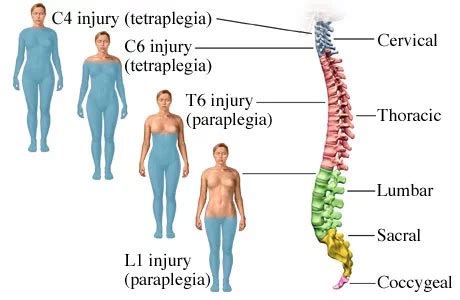 Neural Stem Cell Treatment for Spinal Cord Injuries (SCI)