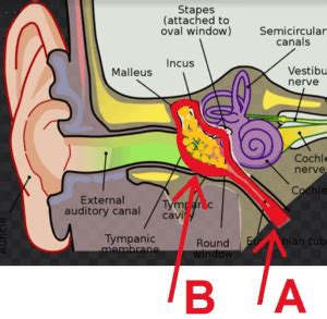 How To Determine An Ear Infection