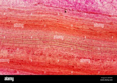 Pumpkin stem longitudinal section showing spiral tracheids (xylem). Photomicrograph Stock Photo ...