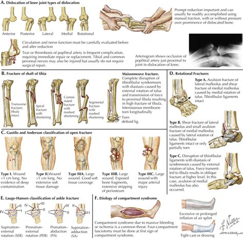 Acute Fractures and Dislocations in Athletes | Musculoskeletal Key