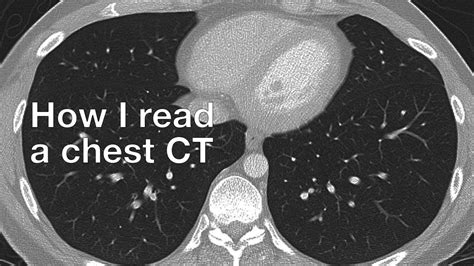 Lung Ct Scan Without Contrast