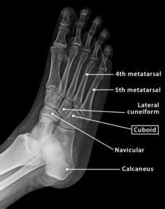 Cuboid Bone - Definition, Location, Anatomy, & Diagram