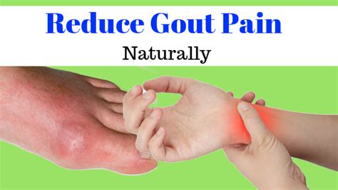 5 Simple Home Remedies For Gout Attack & Pain