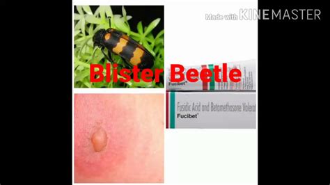 Blister Beetles Bites