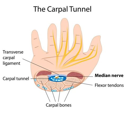 Your Perfect Carpal Tunnel Office Ergonomics To Relieve Wrist Pain