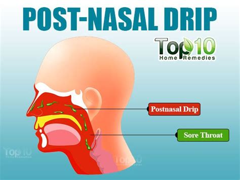 Home Remedies for Post-Nasal Drip | Top 10 Home Remedies