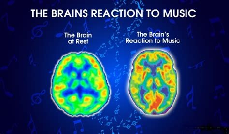 How music affects your brain | Enterprise