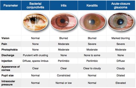 Rapid Review: Red Eye - RoshReview.com