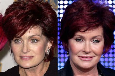 Sharon Osbourne – another victim of plastic surgery?