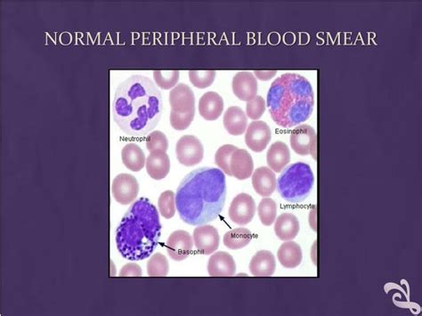 PPT - Blood smear examination PowerPoint Presentation - ID:1281696