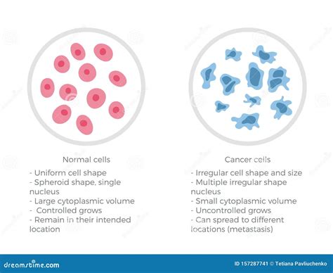 Cell Structure: Normal and Cancer Stock Vector - Illustration of anatomy, malignant: 157287741