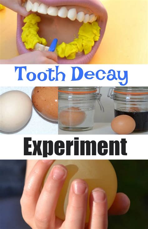 Tooth Decay Experiment with Egg shells